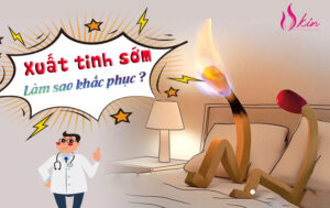 Điều trị xuất tinh sớm